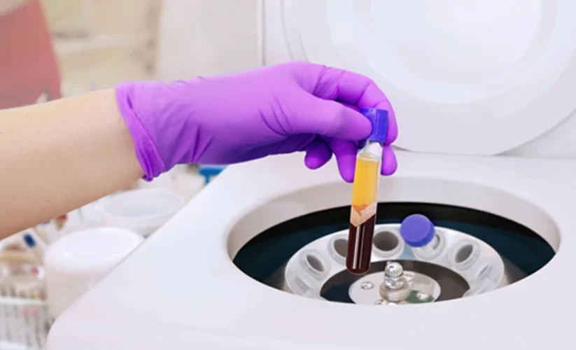 PRP Therapy for Fertility: Endometrial & Intraovarian Benefits